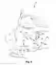 Fig. 07 - Surgical guide and method for guiding a therapy delivery device into the pterygopalatine fossa