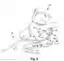 Fig. 09 - Surgical guide and method for guiding a therapy delivery device into the pterygopalatine fossa