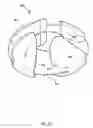 Fig. 22 - Rotary blood pump and control system therefor