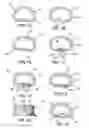Fig. 02 - Annular repair device and method