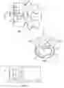 Fig. 02 - Spinal nucleus replacement implant