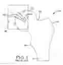 Fig. 02 - MODULAR ORTHOPAEDIC COMPONENT CASE
