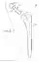 Fig. 09 - MODULAR ORTHOPAEDIC COMPONENT CASE