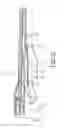 Fig. 06 - Crossbow angled grip