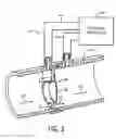 Fig. 04 - System and method for a flow sensor