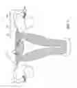 Fig. 02 - MEDICAL DEVICES AND METHODS OF MAKING AND USING SUCH DEVICES