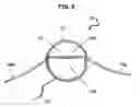 Fig. 06 - Mosquito spring net