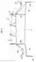 Fig. 07 - Mosquito spring net