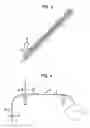 Fig. 03 - Component feeder
