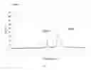 Fig. 02 - Process for analyzing sample by capillary electrophoresis method