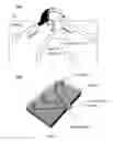 Fig. 02 - Nanofluidic preconcentration device in an open environment