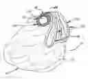 Fig. 01 - Combined drape and carrying bag unit