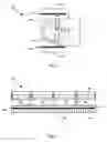 Fig. 02 - High-resolution single photon planar and spect imaging of brain and neck employing a system of two co-registered opposed gamma imaging heads