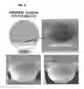 Fig. 09 - PREPARATION METHOD FOR MICRO-CAPSULE USING A MICROFLUIDIC CHIP SYSTEM