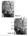 Fig. 05 - Perfecting the effect of flash within an image acquisition devices using face detection