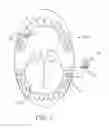 Fig. 02 - Actuator systems for oral-based appliances