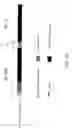 Fig. 09 - Use of gp130 activators in diabetic neuropathy