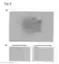 Fig. 07 - Method of constructing masses of myocardial cells and use of the myocardial cell mass
