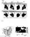 Fig. 04 - METHODS AND COMPOSITIONS TO TREAT ARRHYTHMIAS