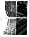 Fig. 06 - METHODS AND COMPOSITIONS TO TREAT ARRHYTHMIAS