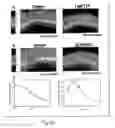 Fig. 46 - METHODS AND COMPOSITIONS TO TREAT ARRHYTHMIAS