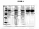 Fig. 07 - Adaptation of Pitman Moore strain of rabies virus to primary chick embryo fibroblast cell cultures