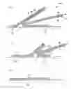 Fig. 01 - Percutaneous absorption type patch