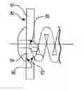 Fig. 01 - IMPLANTABLE OCULAR DRUG DELIVERY DEVICE AND METHODS