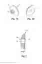 Fig. 07 - IMPLANTABLE OCULAR DRUG DELIVERY DEVICE AND METHODS