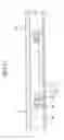 Fig. 16 - Foamed molding with soft insert component and its molding method