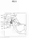Fig. 07 - TRANSFER JIG FOR BRACKET OR TUBE, MANUFACTURING AND USING METHOD THEREOF