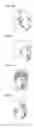 Fig. 02 - NASAL AND MAXILLARY GROWTH ENHANCER