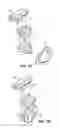 Fig. 07 - ORTHODONTIC AUXILIARY DEVICE HAVING A SWIVEL FOR ADAPTING TO IMPLANTS