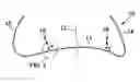 Fig. 01 - ORTHODONTIC ARCH WIRE AND METHOD FOR USING THE SAME