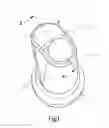 Fig. 02 - STUD BLANK FOR A DENTAL IMPLANT