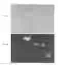 Fig. 03 - Materials and Methods for Screening, Diagnosis and Prognosis of Conditions Associated With Stat Protein Expression