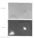 Fig. 08 - Materials and Methods for Screening, Diagnosis and Prognosis of Conditions Associated With Stat Protein Expression