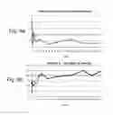 Fig. 09 - Non-invasive marker for liver function and disease