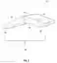 Fig. 02 - Methods and devices for treating pathological conditions of the human knee