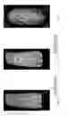Fig. 08 - Personal Care Article For Sequentially Dispensing Compositions With Variable Concentrations Of Hydrophobic Benefit Materials