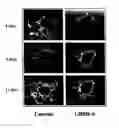 Fig. 01 - METHODS FOR REDUCING GNRH-POSITIVE TUMOR CELL PROLIFERATION
