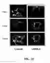 Fig. 09 - METHODS FOR REDUCING GNRH-POSITIVE TUMOR CELL PROLIFERATION