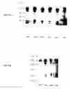 Fig. 16 - METHODS FOR REDUCING GNRH-POSITIVE TUMOR CELL PROLIFERATION