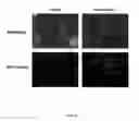 Fig. 12 - METHOD OF TREATING CANCER USING ATP SYNTHASE INHIBITORS