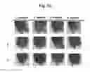 Fig. 11 - Composition for treating atopic dermatitis comprising hirsutenone as an active ingredient