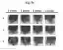 Fig. 14 - Composition for treating atopic dermatitis comprising hirsutenone as an active ingredient