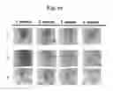 Fig. 19 - Composition for treating atopic dermatitis comprising hirsutenone as an active ingredient