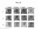 Fig. 20 - Composition for treating atopic dermatitis comprising hirsutenone as an active ingredient