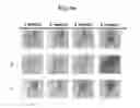 Fig. 21 - Composition for treating atopic dermatitis comprising hirsutenone as an active ingredient