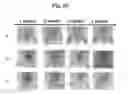 Fig. 22 - Composition for treating atopic dermatitis comprising hirsutenone as an active ingredient